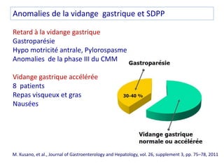 Anomalies de la vidange gastrique et SDPP
Retard à la vidange gastrique
Gastroparésie
Hypo motricité antrale, Pylorospasme...