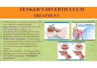 ZENKER’S DIVERTICULUM
TREATMENT
 Treatment involves surgery because there
is no effective medical therapy
 Open Surgery: Diverticulectomy with
Cricopharyngeal myotomy or
Diverticulopexy is performed through a
Lt neck incision for large diverticulum.
 If diverticulum is <2cms only Myotomy
 Endoscopic myotomy- An operating
laryngoscope is used to expose the neck of
the diverticulum, and a myotomy is
performed using an endoscopic linear
stapler.
 With this technique , the diverticulum
becomes part of a common channel with
the cervical esophagus- “Dohlman’s
procedure”.
 