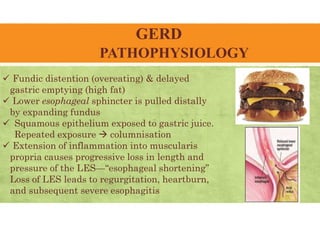 GERD
PATHOPHYSIOLOGY
 Fundic distention (overeating) & delayed
gastric emptying (high fat)
 Lower esophageal sphincter is pulled distally
by expanding fundus
 Squamous epithelium exposed to gastric juice.
Repeated exposure  columnisation
 Extension of inflammation into muscularis
propria causes progressive loss in length and
pressure of the LES—“esophageal shortening”
Loss of LES leads to regurgitation, heartburn,
and subsequent severe esophagitis
 