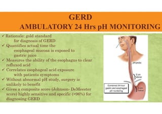 GERD
AMBULATORY 24 Hrs pH MONITORING
 Rationale: gold standard
for diagnosis of GERD
 Quantifies actual time the
esophageal mucosa is exposed to
gastric juice
 Measures the ability of the esophagus to clear
refluxed acid
 Correlates esophageal acid exposure
with patients symptoms
 Without abnormal pH study, surgery is
unlikely to benefit
 Gives a composite score (Johnson- DeMeester
score) highly sensitive and specific (>96%) for
diagnosing GERD
 