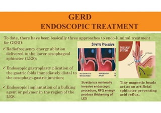 GERD
ENDOSCOPIC TREATMENT
To date, there have been basically three approaches to endo-luminal treatment
for GERD:
 Radiofrequency energy ablation
delivered to the lower oesophageal
sphincter (LES);
 Endoscopic gastroplasty plication of
the gastric folds immediately distal to
the oesophago-gastric junction;
 Endoscopic implantation of a bulking
agent or polymer in the region of the
LES.
Tiny magnetic beads
act as an artificial
sphincter preventing
acid reflux.
Stretta is a minimally
invasive endoscopic
procedure, RFQ energy
produce thickening of
LES
 