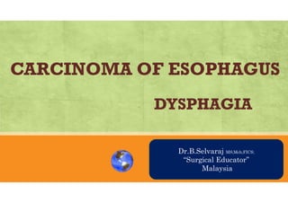 CARCINOMA OF ESOPHAGUS
DYSPHAGIA
AN OVRVIEWDr.B.Selvaraj MS;Mch;FICS;
“Surgical Educator”
Malaysia
 
