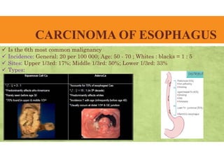 CARCINOMA OF ESOPHAGUS
 Is the 6th most common malignancy
 Incidence: General: 20 per 100 000; Age: 50 - 70 ; Whites : blacks = 1 : 5
 Sites: Upper 1/3rd: 17%; Middle 1/3rd: 50%; Lower 1/3rd: 33%
 Types:
 