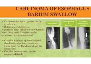 CARCINOMA OF ESOPHAGUS
BARIUM SWALLOW
 Recommended for all patients with
dysphagia
 Differentiates between…
a) intrinsic mass (protrudes into lumen)
b) extrinsic mass (compression by
structures outside esophagus)
 Classical findings: apple core lesion,
shouldering sign (near-horizontal
upper border of Ba+shadow), rat tail
appearance
 Can also demonstrate tracheo-
esophageal fistula
Apple Core
Shouldering
&
Rat tail
Tracheo-
esophageal
fistula
 
