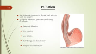 Palliation
 For patients with extensive disease and who are
unfit for surgery.
 Main aim is to relief symptoms particularly
dysphagia
 Endoscopic dilatation
 Stent insertion
 Laser ablation
 Radiotherapy and chemotherapy
 Analgesia and terminal care
42
 