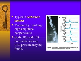 Dysphagia and adenoid phages diagnosis and management sign and symptom ...