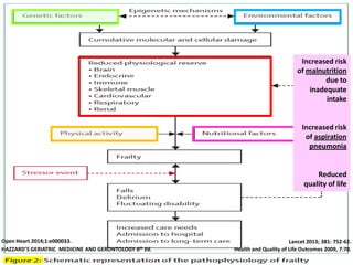 Dysphagia in the elderly@apr2014 present | PDF