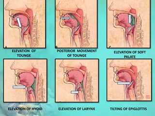 ELEVATION OF
TOUNGE
POSTERIOR MOVEMENT
OF TOUNGE
ELEVATION OF SOFT
PALATE
ELEVATION OF HYOID ELEVATION OF LARYNX TILTING OF EPIGLOTTIS
 