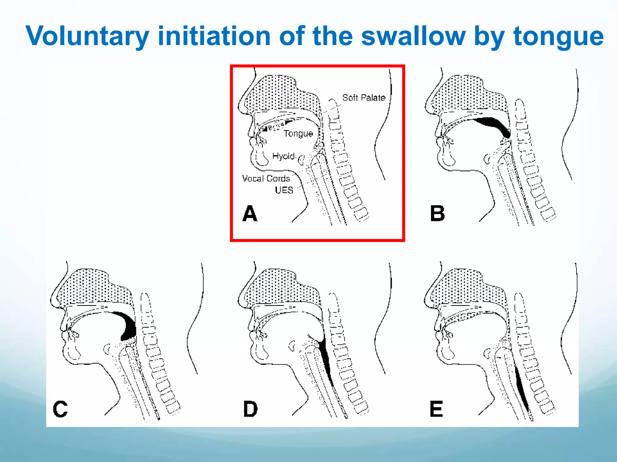 Dysphagia PowerPoint.pptx