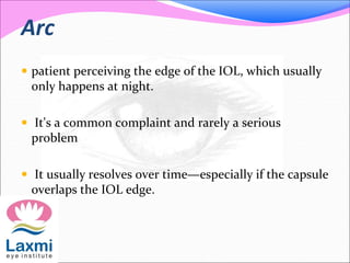 Arc
 patient perceiving the edge of the IOL, which usually
only happens at night.
 It's a common complaint and rarely a serious
problem
 It usually resolves over time—especially if the capsule
overlaps the IOL edge.
 