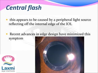 Central flash
 this appears to be caused by a peripheral light source
reflecting off the internal edge of the IOL
 Recent advances in edge design have minimized this
symptom
 