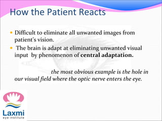 How the Patient Reacts
 Difficult to eliminate all unwanted images from
patient's vision.
 The brain is adapt at eliminating unwanted visual
input by phenomenon of central adaptation.
the most obvious example is the hole in
our visual field where the optic nerve enters the eye.
 