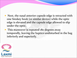  Next, the nasal anterior capsule edge is retracted with
one Sinskey hook (or similar device) while the optic
edge is elevated and the capsule edge allowed to slip
under the optic.
 This maneuver is repeated 180 degrees away
temporally, leaving the haptics undisturbed in the bag
inferiorly and superiorly.
 