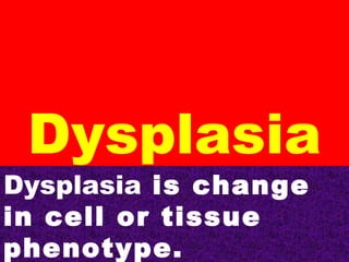 Dysplasia

Dysplasia is change
in cell or tissue
phenotype.

 