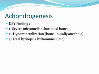 Achondrogenesis
 KEY Finding :
 1- Severe micromelia (shortened bones)
 2- Hypomineralization (bone unusally anechoic)
 3- Fetal hydrops + hydramnios (late)
 