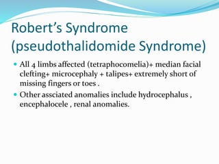 Robert’s Syndrome
(pseudothalidomide Syndrome)
 All 4 limbs affected (tetraphocomelia)+ median facial
clefting+ microcephaly + talipes+ extremely short of
missing fingers or toes .
 Other assciated anomalies include hydrocephalus ,
encephalocele , renal anomalies.
 
