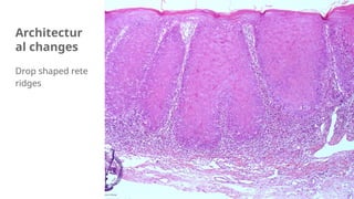 Rete Ridges Structure Dysplastic features of oral premalignant lesions and conditions.pptx