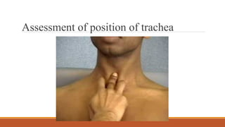 Assessment of position of trachea
 