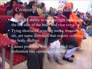 13
Crossing the Body Midline
• This is the ability to use the right hand on
the left side of the body and vice versa.
• Tying shoelaces, wearing socks, trousers
etc. are some activities that require crossing
the body midline.
• Causes problems with two handed co-
ordination like opening a jam bottle.
 