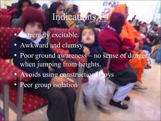 23
Indications - 4
• Extremely excitable.
• Awkward and clumsy.
• Poor ground awareness – no sense of danger
when jumping from heights.
• Avoids using constructional toys
• Peer group isolation
 