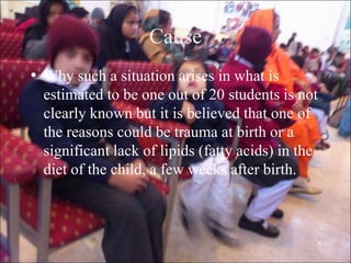 6
Cause
• Why such a situation arises in what is
estimated to be one out of 20 students is not
clearly known but it is believed that one of
the reasons could be trauma at birth or a
significant lack of lipids (fatty acids) in the
diet of the child, a few weeks after birth.
 