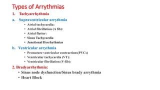 Dysrhythmia [Autosaved].pptx