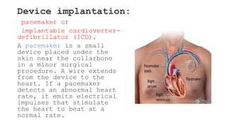 Dysrhythmia [Autosaved].pptx