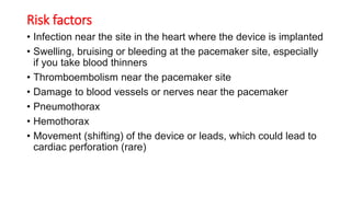 Dysrhythmia [Autosaved].pptx