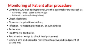 Dysrhythmia [Autosaved].pptx