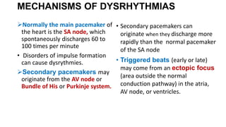 Dysrhythmia [Autosaved].pptx
