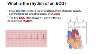 Dysrhythmia [Autosaved].pptx