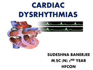 CARDIAC
DYSRHYTHMIAS
SUDESHNA BANERJEE
M.SC (N) 2ND YEAR
HFCON
 