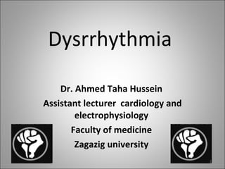 Dysrrhythmia

    Dr. Ahmed Taha Hussein
Assistant lecturer cardiology and
        electrophysiology
       Faculty of medicine
        Zagazig university
                                    2
 