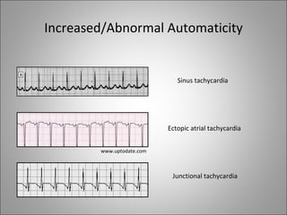 Increased/Abnormal Automaticity


                              Sinus tachycardia




                           Ectopic atrial tachycardia


        www.uptodate.com



                            Junctional tachycardia
 