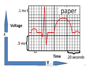 Dysrrhythmia, major arrhythmias and management, bascs of ECG. | PPSX