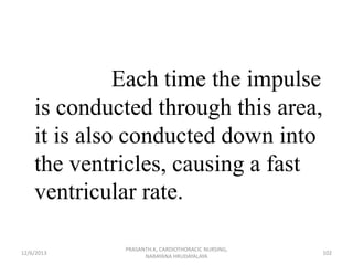 Each time the impulse
is conducted through this area,
it is also conducted down into
the ventricles, causing a fast
ventri...