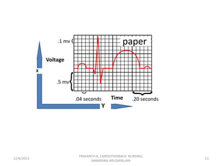 paper

.1 mv

Voltage

.5 mv

.04 seconds

12/6/2013

Time

.20 seconds

PRASANTH.K, CARDIOTHORACIC NURSING,
NARAYANA HRUD...