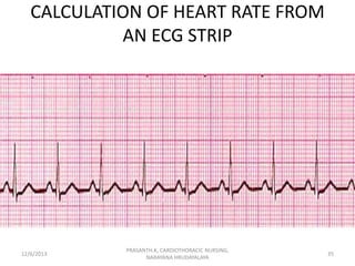 CALCULATION OF HEART RATE FROM
AN ECG STRIP

12/6/2013

PRASANTH.K, CARDIOTHORACIC NURSING,
NARAYANA HRUDAYALAYA

35

 