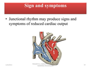 Sign and symptoms
• Junctional rhythm may produce signs and
symptoms of reduced cardiac output

12/6/2013

PRASANTH.K, CAR...