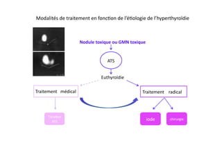 Modalités	
  de	
  traitement	
  en	
  fonc2on	
  de	
  l’é2ologie	
  de	
  l’hyperthyroïdie	
  
Nodule	
  toxique	
  ou	
  GMN	
  toxique	
  
Euthyroïdie	
  
ATS	
  
Traitement	
  	
  	
  médical	
   Traitement	
  	
  	
  	
  radical	
  
iode	
   chirurgie	
  
Titra2on	
  
ATS	
  
 