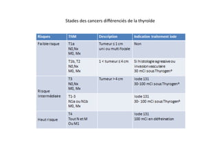 Stades	
  des	
  cancers	
  diﬀérenciés	
  de	
  la	
  thyroïde	
  
 