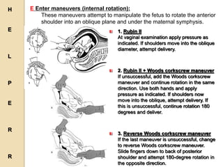 E Enter maneuvers (internal rotation):
These maneuvers attempt to manipulate the fetus to rotate the anterior
shoulder into an oblique plane and under the maternal symphysis.
1. Rubin II
At vaginal examination apply pressure as
indicated. If shoulders move into the oblique
diameter, attempt delivery.
2. Rubin II + Woods corkscrew maneuver
If unsuccessful, add the Woods corkscrew
maneuver and continue rotation in the same
direction. Use both hands and apply
pressure as indicated. If shoulders now
move into the oblique, attempt delivery. If
this is unsuccessful, continue rotation 180
degrees and deliver.
3. Reverse Woods corkscrew maneuver
If the last maneuver is unsuccessful, change
to reverse Woods corkscrew maneuver.
Slide fingers down to back of posterior
shoulder and attempt 180-degree rotation in
the opposite direction.
H
E
L
P
E
R
R
 