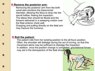 R Remove the posterior arm:
Removing the posterior arm from the birth
canal also shortens the bisacromial
diameter, allowing the fetus to drop into the
sacral hollow, freeing the impaction.
The elbow then should be flexed and the
forearm delivered in a sweeping motion over
the fetal anterior chest wall.
Grasping and pulling directly on the fetal arm
may fracture the humerus.
R Roll the patient:
The patient rolls from her existing position to the all-fours position.
Often, the shoulder will dislodge during the act of turning, so that this
movement alone may be sufficient to dislodge the impaction.
In addition, once the position change is completed, gravitational forces
may aid in the disimpaction of the fetal shoulders.
H
E
L
P
E
R
R
 