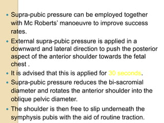  Supra-pubic pressure can be employed together
with Mc Roberts’ manoeuvre to improve success
rates.
 External supra-pubic pressure is applied in a
downward and lateral direction to push the posterior
aspect of the anterior shoulder towards the fetal
chest .
 It is advised that this is applied for 30 seconds.
 Supra-pubic pressure reduces the bi-sacromial
diameter and rotates the anterior shoulder into the
oblique pelvic diameter.
 The shoulder is then free to slip underneath the
symphysis pubis with the aid of routine traction.
 
