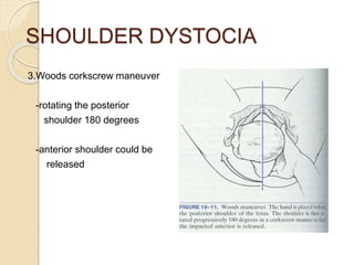 SHOULDER DYSTOCIA
3.Woods corkscrew maneuver
-rotating the posterior
shoulder 180 degrees
-anterior shoulder could be
released
 
