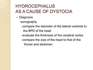 HYDROCEPHALUS
AS A CAUSE OF DYSTOCIA
 Diagnosis
:sonography
-compare the diameter of the lateral ventricle to
the BPD of the head
-evaluate the thickness of the cerebral cortex
-compare the size of the head to that of the
thorax and abdomen
 
