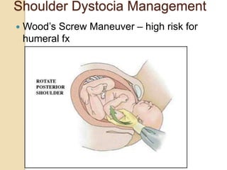 Shoulder Dystocia Management
 Wood’s Screw Maneuver – high risk for
humeral fx
 