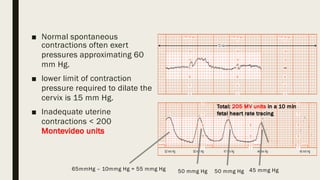 Normal Contraction dystocia.pdfdystociapptdownloadpleasereadit | PDF