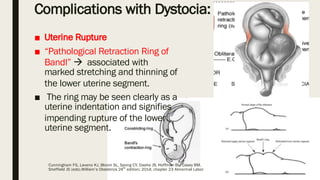 Pathologic Retraction Ring dystocia.pdfdystociapptdownloadpleasereadit | PDF