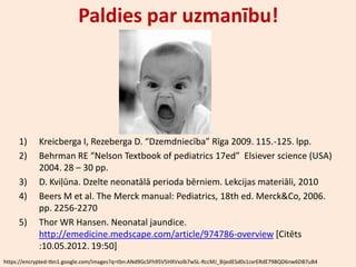 Paldies par uzmanību!




     1)     Kreicberga I, Rezeberga D. “Dzemdniecība” Rīga 2009. 115.-125. lpp.
     2)     Behrman RE “Nelson Textbook of pediatrics 17ed” Elsiever science (USA)
            2004. 28 – 30 pp.
     3)     D. Kviļūna. Dzelte neonatālā perioda bērniem. Lekcijas materiāli, 2010
     4)     Beers M et al. The Merck manual: Pediatrics, 18th ed. Merck&Co, 2006.
            pp. 2256-2270
     5)     Thor WR Hansen. Neonatal jaundice.
            http://emedicine.medscape.com/article/974786-overview *Citēts
            :10.05.2012. 19:50]
https://encrypted-tbn1.google.com/images?q=tbn:ANd9GcSFh95V5HXVxzlb7wSL-RccMJ_BijedESd0s1cxrERdE79BQD6nw6DB7uB4
 
